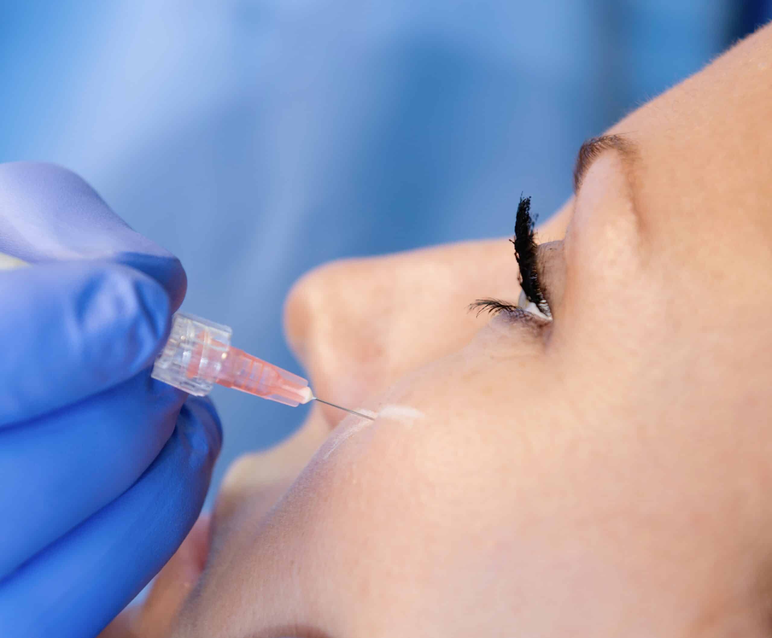 Hyaluronic acid injection